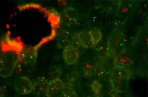 Fluorescence Filters in Bioimaging